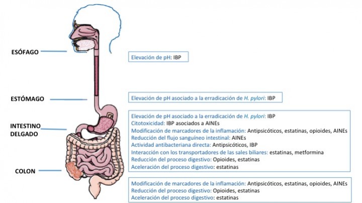 interacciones de microbiota intestinal con obesidad, resistencia a la insulina y diabetes tipo 2